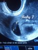 baby2-klein.jpg
