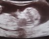 baby_skull.jpg