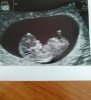scan.jpg
