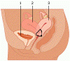 bm1.gif
