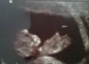 Baby 11 weken, 4,5 cm groot 2.jpg