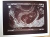 baby a 1.jpg