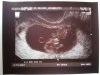 baby b 1.jpg