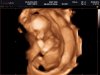 Baby jongen 3d.jpg