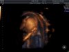 Babydroesjka - 3D handjes voor gezicht 2 - 13092014.jpg