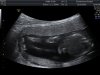 Babydroesjka - Lange benen - 13092014.jpg
