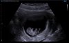 Echo9w6d.jpg