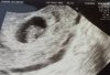 1eee echo 17-9-14.jpg