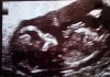 babyb.jpg