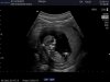 Gladys_20140923__0009.jpg