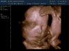 baby voetje 6-10-2014.jpg