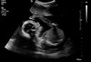 baby.jpg