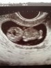 echo 10.3 wkn.jpg