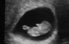 baby uitvergroot.jpg