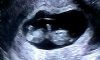 VIDEO0009_0000017715.jpg