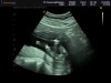 BABY_0007.jpg
