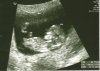 echo3_23april_klein.jpg