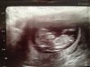 fotobaby.jpg