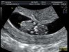 Echo week 10 - 24-10-2014 05.jpg