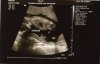 16.2 wk, gesl. echo, jongen, 25-10-14.jpg