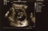 16.2 wk, gesl. echo, jongen, 25-10-14-b.jpg