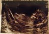 echo baby 2 12-3 anoniem.jpg