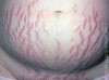 rid-stretch-marks-cheap-products-800x800.jpg