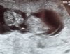 baby1.jpg