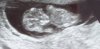 baby2.jpg