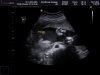 ECHOWONDER_0010.jpg