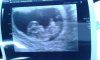 IMG-20141124-WA0000.jpg