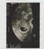 echo 25-11-2014.jpg