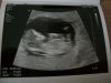 100_1780.jpg