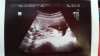 Echo week 14 - 29-11-2014.jpg