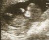 baby1.jpg