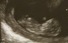 baby2.jpg