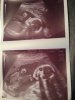 echo20wk.jpg