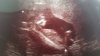 20150121_155824.jpg