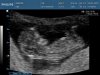 baby Visser - termijnecho_0015 - kopie.jpg
