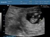 baby Visser - termijnecho_0011 - kopie.jpg