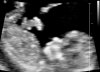 patient8239005.jpg
