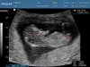 baby Visser - termijnecho_0003 - kopie.jpg