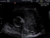 echo 29-01-2015_0.jpg