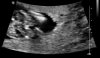 patient8239007 (2).jpg