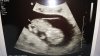 echo 10 wk.jpg