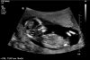 patient8300300 - kopie.jpg