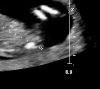 patient8300300 - kopie - kopie.jpg