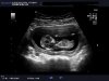 baby b 1.JPG