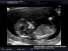 baby b 3.JPG