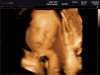 BABY BRUGGE_0035.jpg